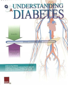 Understanding Diabetes Flip Chart by Scientific Publishing, 9781932922325