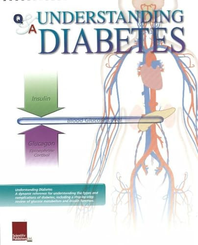 Understanding Diabetes Flip Chart by Scientific Publishing, 9781932922325