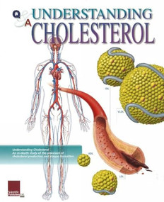 Understanding Cholesterol Flip Chart by Scientific Publishing, 9781932922332