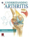 Understanding Arthritis Flip Chart by Scientific Publishing, 9781932922288