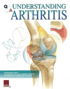 Understanding Arthritis Flip Chart by Scientific Publishing, 9781932922288