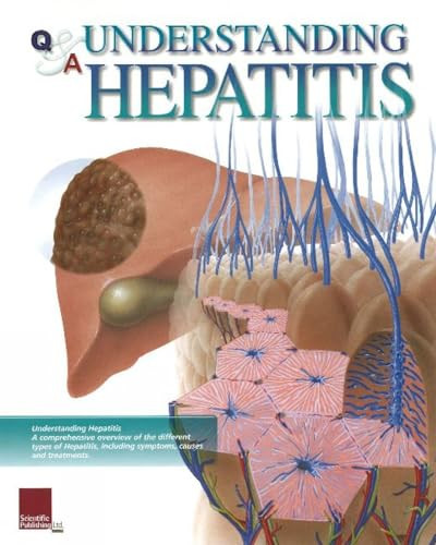 Understanding Hepatitis Flip Chart by Scientific Publishing, 9781932922349
