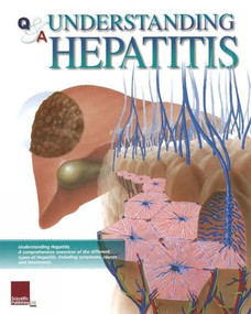 Understanding Hepatitis Flip Chart by Scientific Publishing, 9781932922349