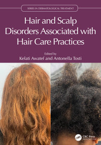 Hair and Scalp Disorders Associated with Hair Care Practices by Kelati Awatef, Antonella Tosti, 9781041001911