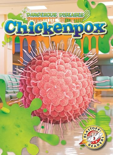 Chicken Pox by Rebecca Pettiford, 9798898800635
