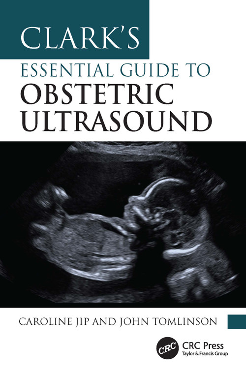 Clark's Essential Guide to Obstetric Ultrasound by Caroline Jip, John Tomlinson, 9781041009771