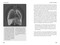 Breathe to Heal with the Buteyko Method (Ease Anxiety, Alleviate Insomnia, and Unlock Your Full Energetic Potential) by Ralph Skuban, Patrick McKeown, 9798888505991