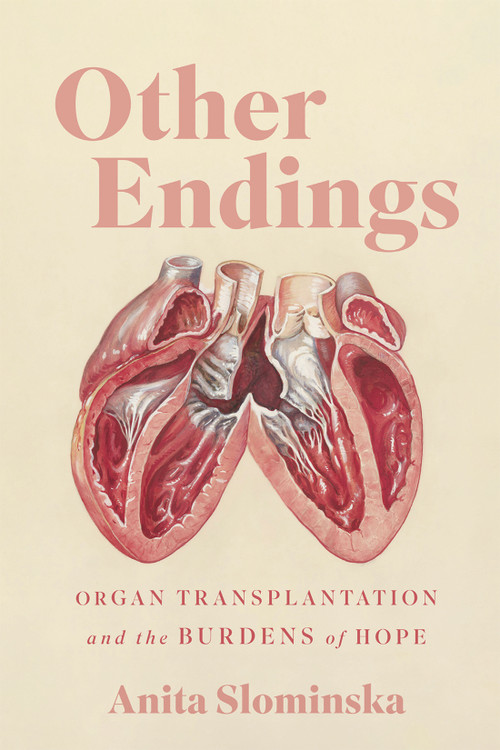Other Endings (Organ Transplantation and the Burdens of Hope) by Anita Slominska, 9780228027195