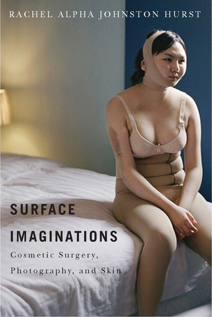 Surface Imaginations (Cosmetic Surgery, Photography, and Skin) by Rachel Alpha Johnston Hurst, 9780773546004