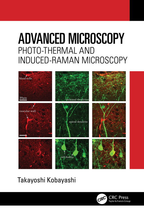 Advanced Microscopy (Photo-Thermal and Induced-Raman Microscopy) by Takayoshi Kobayashi, 9781032758862