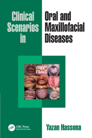 Clinical Scenarios in Oral and Maxillofacial Diseases by Yazan Hassona, 9781041148685