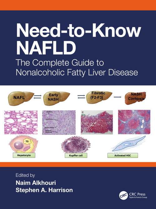 Need-to-Know NAFLD (The Complete Guide to Nonalcoholic Fatty Liver Disease) by Naim Alkhouri, Stephen A. Harrison, 9781032479484