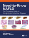 Need-to-Know NAFLD (The Complete Guide to Nonalcoholic Fatty Liver Disease) by Naim Alkhouri, Stephen A. Harrison, 9781032479484