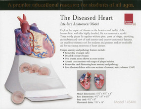 Life Size Diseased Heart Model by Scientific Publishing, 9781932922653