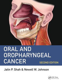 Oral and Oropharyngeal Cancer by Jatin P. Shah, MD, FACS, Newell W. Johnson, CMG, FMedSci MDSc, 9781498700085