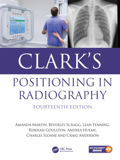 Clark's Positioning in Radiography by Amanda Martin, Ruth Eaves, Beverley Scragg, Leah Fenning, Rebekah Goulston, Andrea Hulme, Charles Sloane, Craig Anderson, 9781041246961