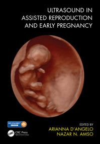 Ultrasound in Assisted Reproduction and Early Pregnancy by Arianna D'Angelo, Nazar N. Amso, 9781138485853