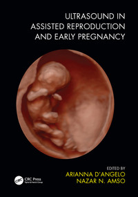 Ultrasound in Assisted Reproduction and Early Pregnancy by Arianna D'Angelo, Nazar N. Amso, 9781138486171