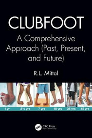 Clubfoot (A Comprehensive Approach (Past, Present, and Future)) by R. L. Mittal, 9781138083738