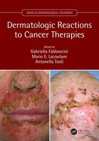 Dermatologic Reactions to Cancer Therapies by Gabriella Fabbrocini, Mario Lacouture, Antonella Tosti, 9781138035539
