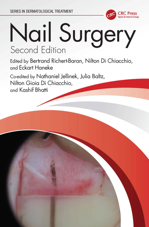 Nail Surgery by Bertrand Richert, Nilton Di Chiacchio, Eckart Haneke, Nathaniel Jellinek, Julia Baltz, Nilton Gioia Di Chiacchio, Kashif Bhatti, 9781032607702