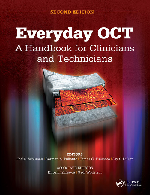 Everyday OCT (A Handbook for Clinicians and Technicians) by Joel S. Schuman, Carmen A. Puliafito, James G. Fujimoto, Jay Duker, 9781630911720