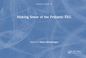 Making Sense of the Pediatric EEG by Maria Montenegro, 9781032486093