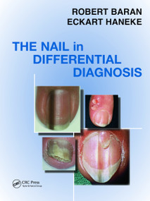 Nail in Differential Diagnosis by Robert Baran, Eckart Haneke, 9781841845067