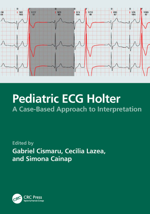 Pediatric ECG Holter (A Case-Based Approach to Interpretation) by Cismaru Gabriel, Cecilia Lazea, Simona Cainap, 9781032898711