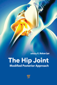 The Hip Joint (Modified Posterior Approach) by K. Mohan Iyer, 9789815129021