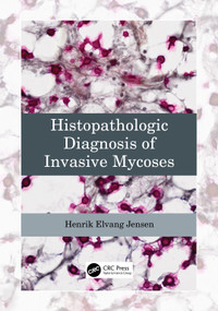 Histopathologic Diagnosis of Invasive Mycoses by Henrik Elvang Jensen, 9781032306704