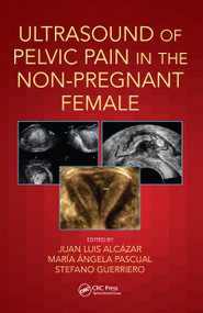 Ultrasound of Pelvic Pain in the Non-Pregnant Patient by Juan Luis Alcázar, María Ángela Pascual, Stefano Guerriero, 9780815364993