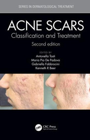 Acne Scars (Classification and Treatment, Second Edition) by Antonell Tosti, Maria Pia De Padova, Gabriella Fabbrocini, Kenneth Beer, 9781138894228