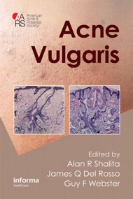 Acne Vulgaris by Alan R. Shalita, James Q. Del Rosso, Guy Webster, 9781841847078