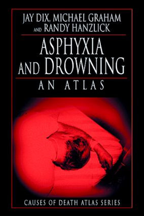 Asphyxia and Drowning (An Atlas) by Jay Dix, Michael Graham, Randy Hanzlick, 9780849323690