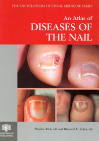 An Atlas of Diseases of the Nail by Phoebe Rich, Richard K. Scher, 9781850705956