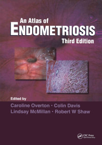 Atlas of Endometriosis by Caroline Overton, Robert W. Shaw, Lindsay McMillan, Colin Davis, 9780415395731