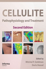 Cellulite (Pathophysiology and Treatment) by Mitchel P. Goldman, Doris Hexsel, 9781439802717