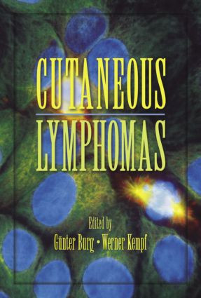 Cutaneous Lymphomas by Gunter Burg, Werner Kempf, 9780824729974