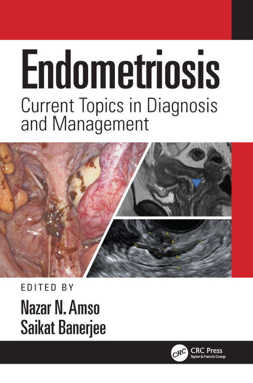 Endometriosis (Current Topics in Diagnosis and Management) by Nazar Amso, Saikat Banerjee, 9781138595873