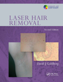 Laser Hair Removal by David J. Goldberg, 9780415414128
