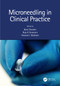 Microneedling in Clinical Practice by Boris Stoeber, Raja K. Sivamani, Howard Maibach, 9781138035690