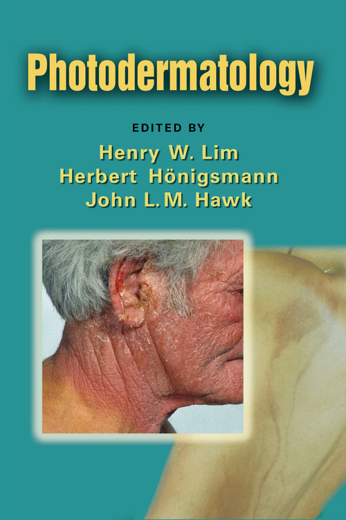 Photodermatology by Henry W. Lim, Herbert Honigsmann, John L. M. Hawk, 9780849374968