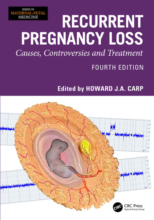 Recurrent Pregnancy Loss (Causes, Controversies and Treatment) by Howard J A Carp, 9781032825243