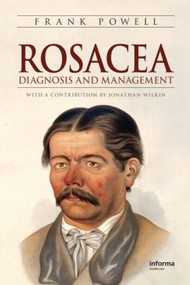 Rosacea (Diagnosis and Management) by Frank Powell, 9781420072587