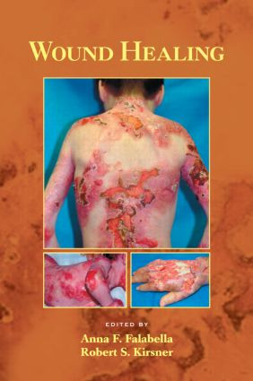 Wound Healing by Anna Falabella, Robert Kirsner, 9780824754587