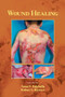 Wound Healing by Anna Falabella, Robert Kirsner, 9780824754587
