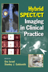 Hybrid SPECT/CT Imaging in Clinical Practice by Ora Israel, Stanley J. Goldsmith, 9780824728540