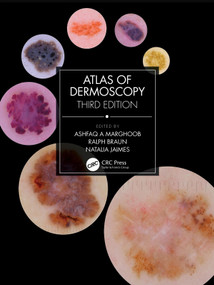 Atlas of Dermoscopy (Third Edition) by Ashfaq A Marghoob, Ralph Braun, Natalia Jaimes, 9781138595989