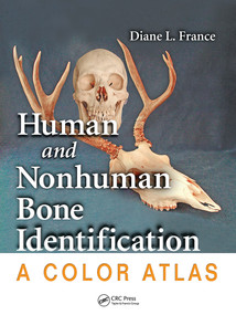 Human and Nonhuman Bone Identification (A Color Atlas) by Diane L. France, 9780367777913